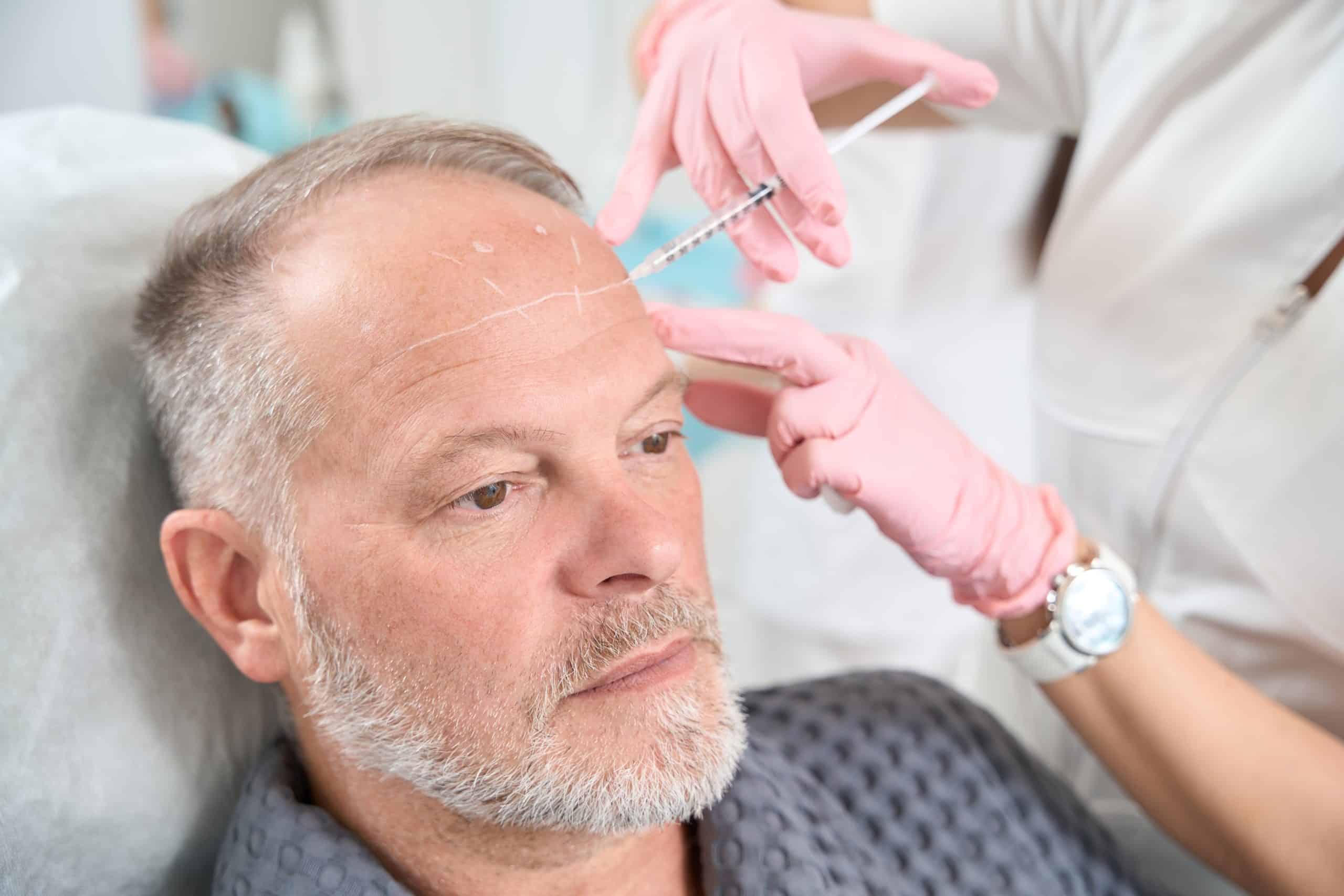 middle-aged man receiving Botox injections for vertical forehead lines