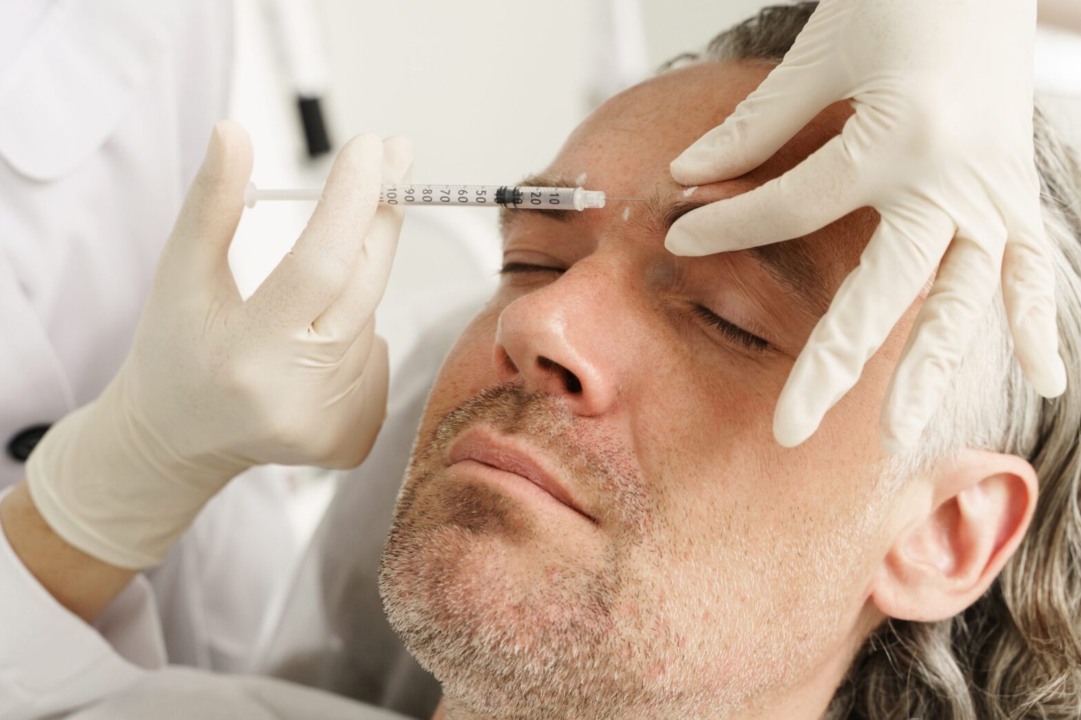 Acid to Fill Wrinkles. What?
